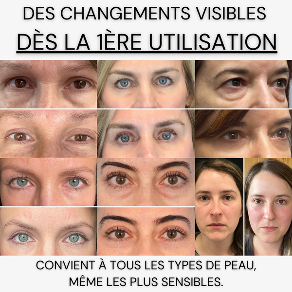 Gem&charm - Patchs Yeux InstaLift au PDRN & Collagène