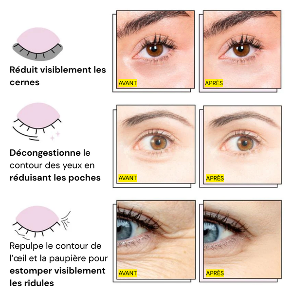 Gem&charm - Patchs Yeux InstaLift au PDRN & Collagène