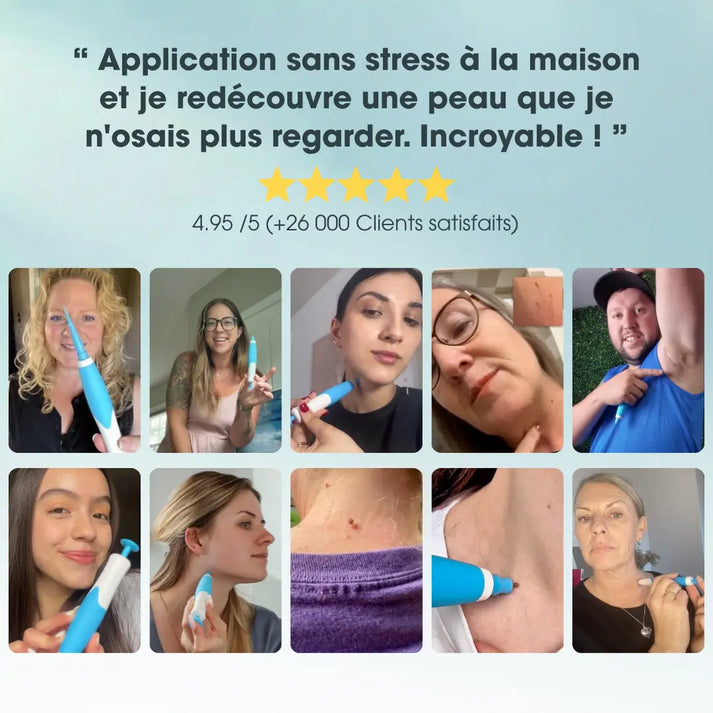 DermaSkin Pro™ - Adieu les acrochordons